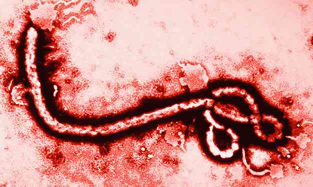 エボラウイルス日本上陸も秒読み!? エボラ患者（新人）一週間で一万人